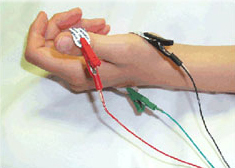 emg test for foot pain