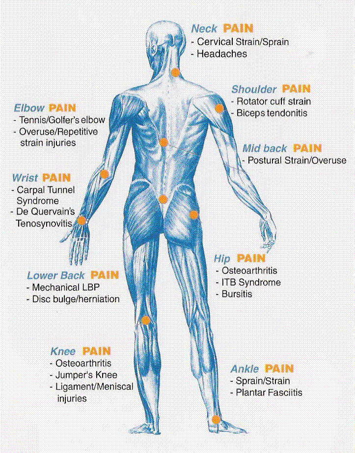 Arthritis Pain Everywhere at Lucille Ainsworth blog