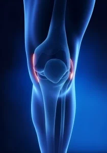 knee pain, pain in the knee, houston knee pain, knee pain houston, the woodlands knee pain, knee pain the woodlands, the woodlands