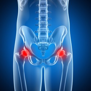 Houston HIP Pain, pain in the hip, hip pain, pain hip