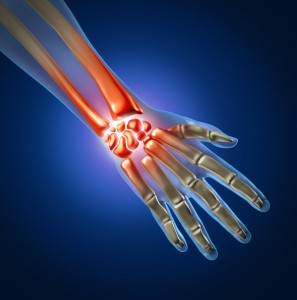 wrist pain Houston, tx, pain in the wrist, hand pain, pain in the hand