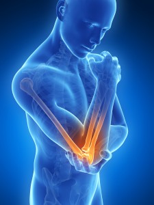 Tennis Elbow, elbow pain, elbow pain houston, houston elbow pain, houston tennis elbow, tennis elbow houston