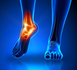 Plantar Fasciitis Treatment in The Woodlands